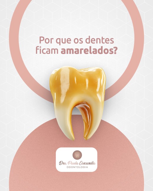 Por que os dentes ficam amarelados?
