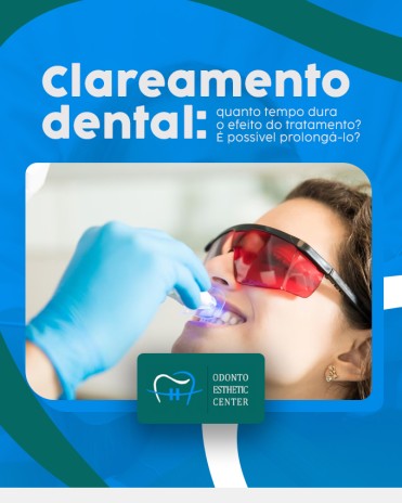 Clareamento dental: quanto tempo dura o efeito do tratamento? É possível prolongá-lo?