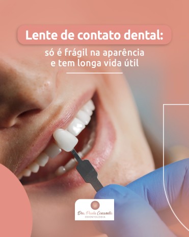 Lente de contato dental: só é frágil na aparência e tem longa vida útil