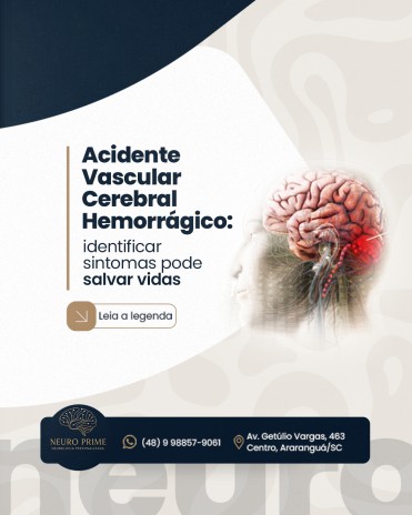 Acidente Vascular Cerebral Hemorrágico: identificar sintomas pode salvar vidas