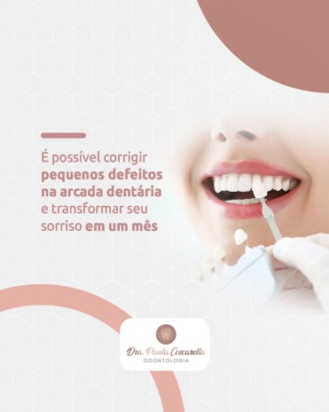É possível corrigir pequenos defeitos na arcada dentária e transformar seu sorriso em um mês