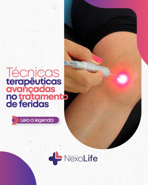 Técnicas terapêuticas avançadas no tratamento de feridas