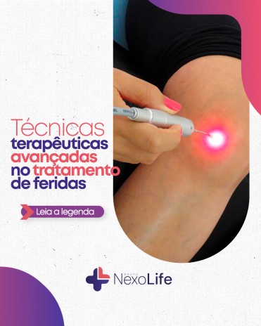 Técnicas terapêuticas avançadas no tratamento de feridas