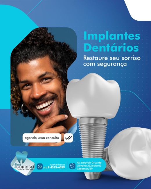 Implantes Dentários em Cajamar: Restaure Seu Sorriso com Segurança