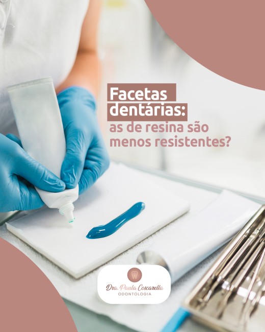Facetas dentárias: as de resina são menos resistentes?