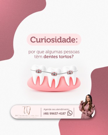 Curiosidade: por que algumas pessoas têm dentes tortos?
