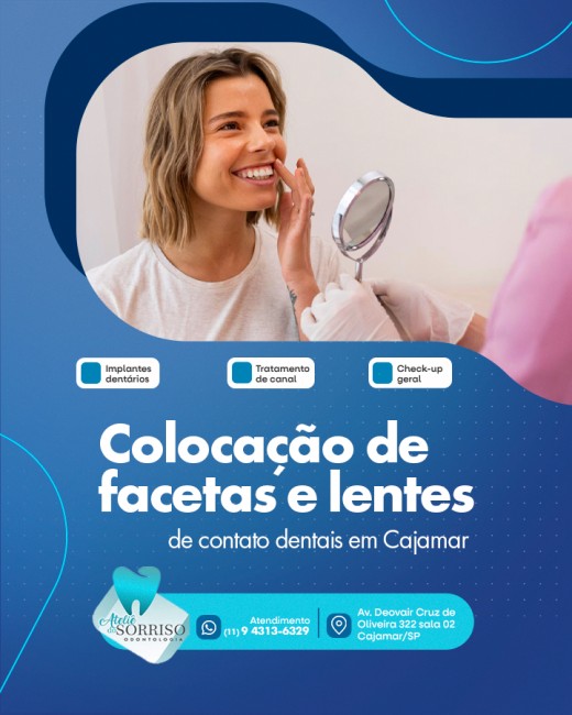 Colocação de facetas e lentes de contato dentais em Cajamar
