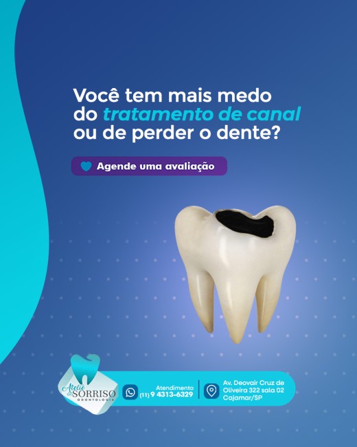 Você tem mais medo do tratamento de canal ou de perder o dente?