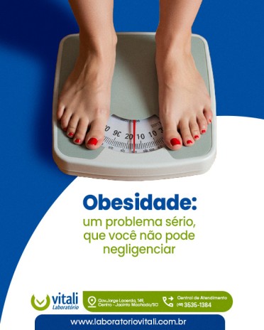 Obesidade: um problema sério, que você não pode negligenciar
