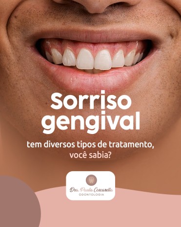 Sorriso gengival tem diversos tipos de tratamento, você sabia?