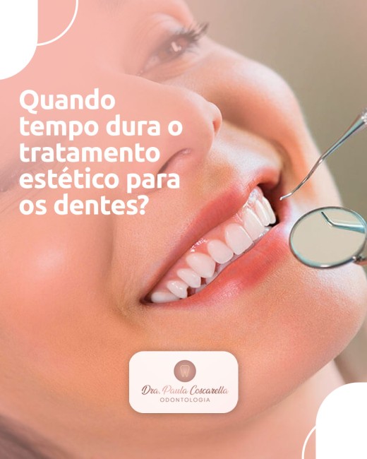 Quando tempo dura o tratamento estético para os dentes?