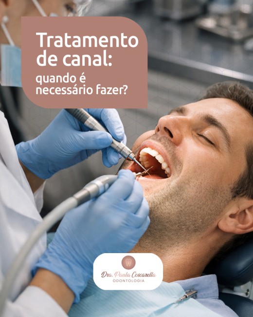 Tratamento de canal: quando é necessário fazer?