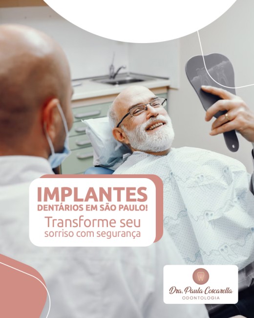 Implantes Dentários em São Paulo Transforme Seu Sorriso com Segurança
