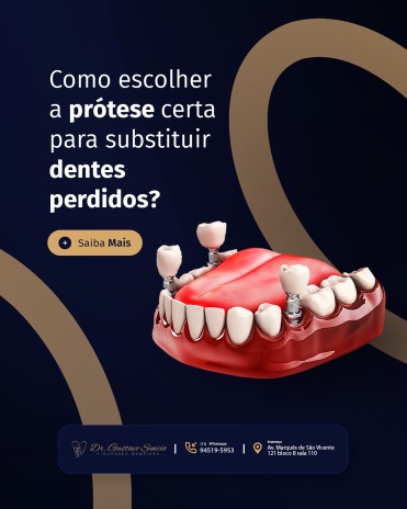 Como escolher a prótese certa para substituir dentes perdidos?